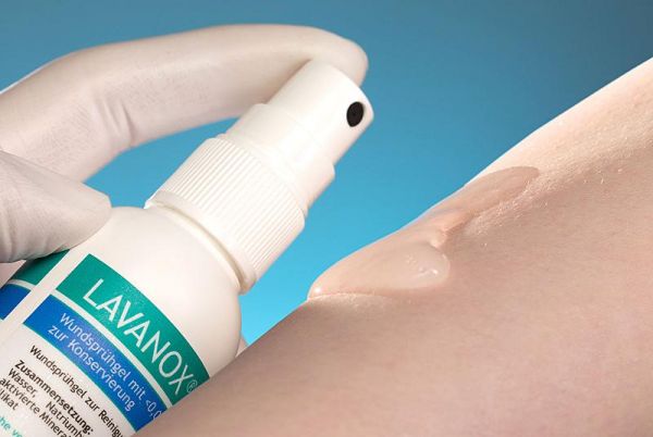 Lavanox® Wundsprühgel, Hydrogel, 75ml