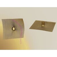 DYNAMESH IPST Netzimplantat 4x17x17 cm